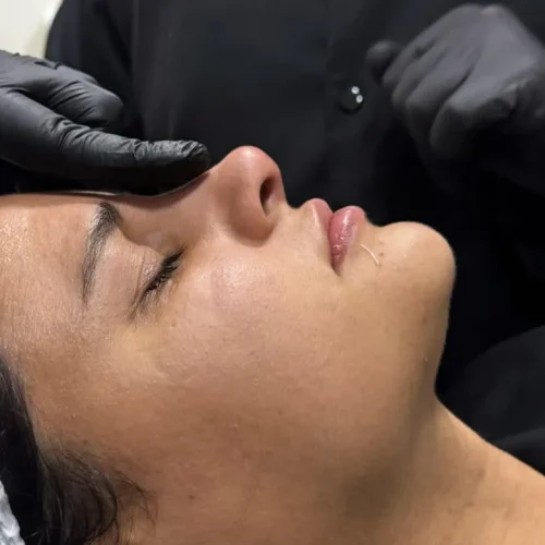 fotos da pós em estética isax 11